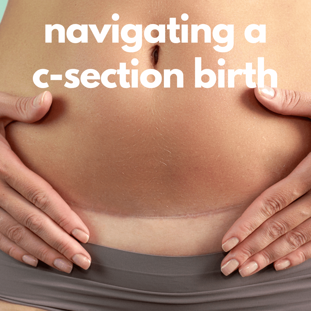 navigating a c-section birth